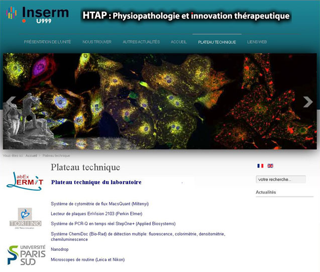Inserm U999 : hypertension artérielle pulmonaire : physiopathologie et innovation thérapeutique